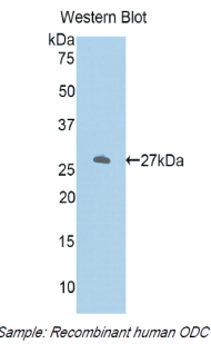 Polyclonal Antibody to Ornithine Decarboxylase (ODC)