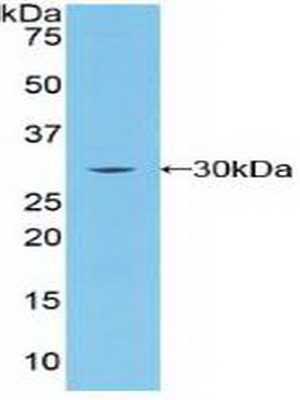 Polyclonal Antibody to Breast Cancer Susceptibility Protein 2 (BRCA2)