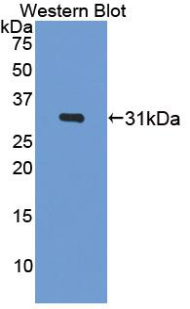 Polyclonal Antibody to Breast Cancer Susceptibility Protein 2 (BRCA2)