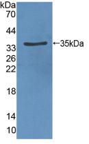 Polyclonal Antibody to Vascular Endothelial Growth Factor Receptor 2 (VEGFR2)
