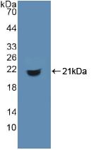 Polyclonal Antibody to Cluster Of Differentiation 74 (CD74)