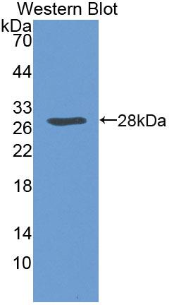 Polyclonal Antibody to Serpin B3 (SERPINB3)