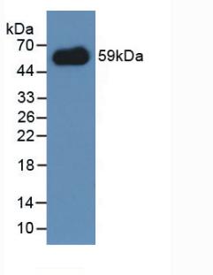 Polyclonal Antibody to Immune Receptor Expressed On Myeloid Cells 1 (IREM1)
