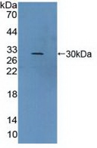 Polyclonal Antibody to Von Willebrand Factor A Domain Containing Protein 2 (vWA2)