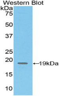 Polyclonal Antibody to Cluster Of Differentiation 97 (CD97)