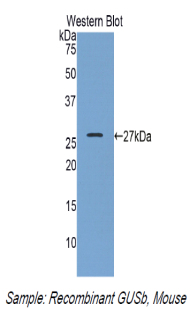Polyclonal Antibody to Glucuronidase Beta (GUSb)