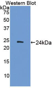 Polyclonal Antibody to Adenylate Cyclase 7 (ADCY7)