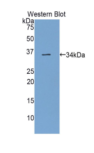 Polyclonal Antibody to Semaphorin 7A (SEMA7A)