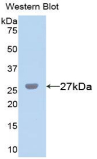 FITC-Linked Polyclonal Antibody to Chitinase-3-like Protein 1 (CHI3L1)
