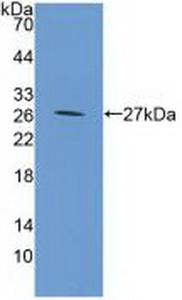 Polyclonal Antibody to Chitinase-3-like Protein 1 (CHI3L1)