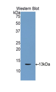 Polyclonal Antibody to Connexin 31 (CX31)