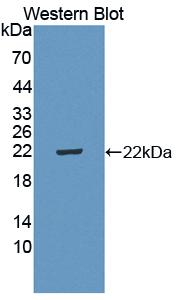 Polyclonal Antibody to Interleukin 5 Receptor Alpha (IL5Ra)