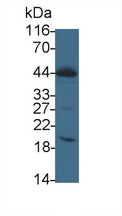 Polyclonal Antibody to Interleukin 2 Receptor Gamma (IL2Rg)