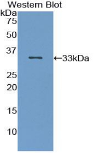 Polyclonal Antibody to Interleukin 1 Receptor Associated Kinase 2 (IRAK2)