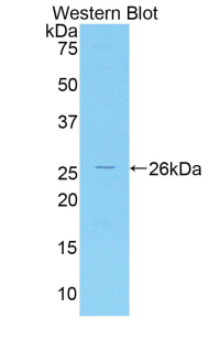 Polyclonal Antibody to Interleukin 1 Receptor Associated Kinase 3 (IRAK3)