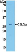 Polyclonal Antibody to Probable ATP-dependent RNA Helicase DDX58 (DDX58)