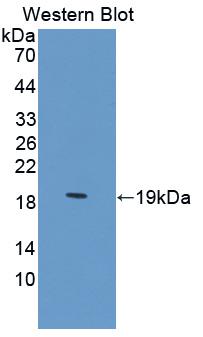 Polyclonal Antibody to Z-DNA Binding Protein 1 (ZBP1)