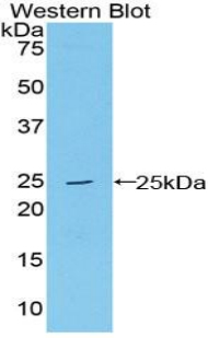 Polyclonal Antibody to Large Multifunctional Peptidase 7 (LMP7)
