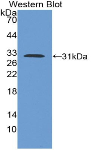 Polyclonal Antibody to Ataxin 2 Binding Protein 1 (A2BP1)