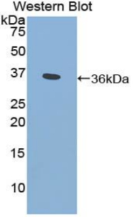 Polyclonal Antibody to Cytochrome P450 Family 21 Subfamily A Member 2 (CYP21A2)