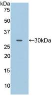 Polyclonal Antibody to Cluster Of Differentiation 32 (CD32)