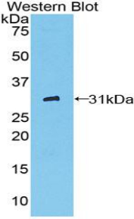 Polyclonal Antibody to Cluster Of Differentiation 32 (CD32)