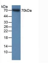 Polyclonal Antibody to Integrin Beta 2 (CD18)