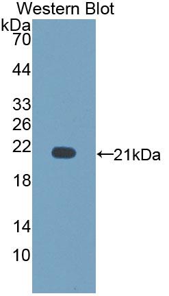 Polyclonal Antibody to Cluster Of Differentiation 164 (CD164)