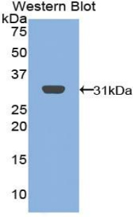Polyclonal Antibody to B-Cell Linker Protein (BLNK)