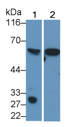 Polyclonal Antibody to Interleukin 10 Receptor Alpha (IL10Ra)