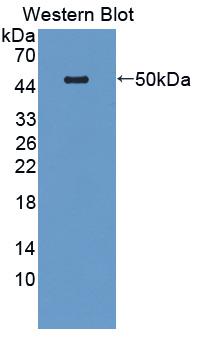 Polyclonal Antibody to Potassium Chloride Cotransporters 3 (KCC3)