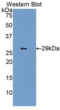 Polyclonal Antibody to Insulin Like Growth Factor 2 Receptor (IGF2R)