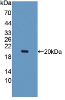 Polyclonal Antibody to Interleukin 10 Receptor Beta (IL10Rb)
