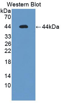 Polyclonal Antibody to Interleukin 12 Receptor Beta 1 (IL12Rb1)