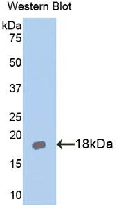 Polyclonal Antibody to Interleukin-18 Receptor Beta (IL18R Beta)
