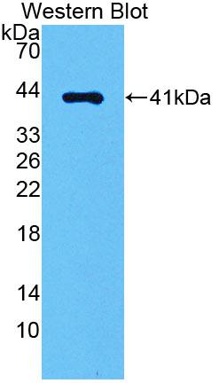 Polyclonal Antibody to Angiotensin II Receptor 1 (AGTR1)