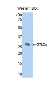 Polyclonal Antibody to Solute Carrier Family 27 Member 5 (SLC27A5)