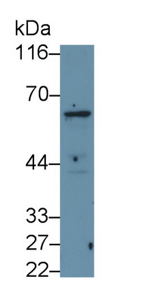 Polyclonal Antibody to Cluster Of Differentiation 226 (CD226)