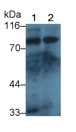 Polyclonal Antibody to Melanotransferrin (MFI2)