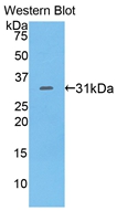 Polyclonal Antibody to Cluster Of Differentiation 229 (C<b>D229</b>)