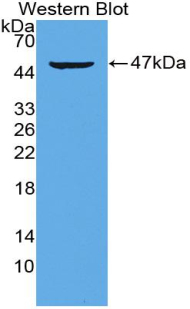 Polyclonal Antibody to Interleukin 21 (IL21)