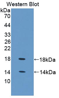 Polyclonal Antibody to Fatty Acid Binding Protein 4 (FABP4)