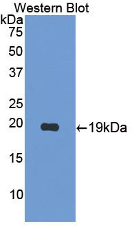 Polyclonal Antibody to Interleukin 17B (IL17B)
