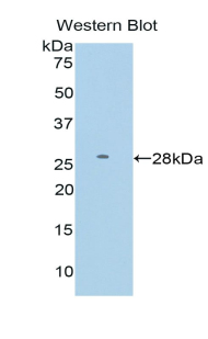 Polyclonal Antibody to Farnesyl Diphosphate Farnesyltransferase 1 (FDFT1)