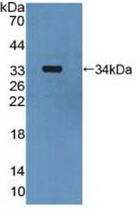 Polyclonal Antibody to Mitogen Activated Protein Kinase Kinase 6 (MAP2K6)