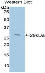 Polyclonal Antibody to Pyridoxal Kinase (PDXK)