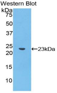 Polyclonal Antibody to Caspase 4 (CASP4)