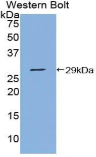 Polyclonal Antibody to Protein Inhibitor Of Activated STAT 1 (PIAS1)