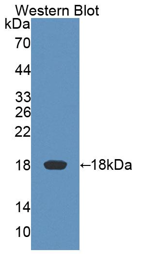 Polyclonal Antibody to Killer Cell Lectin Like Receptor Subfamily K, Member 1 (KLRK1)