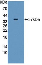 Polyclonal Antibody to Guanylate Binding Protein 4 (GBP4)